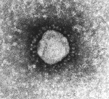 Coronavirus